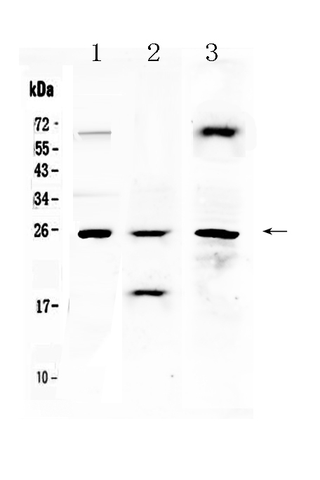 1 - Anti-TIMP4 Picoband Antibody ABO10331