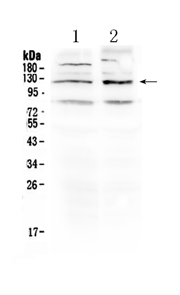 1 - Anti-GABBR1 Picoband Antibody ABO10335