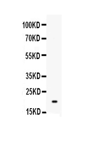 1 - Anti-TREML1 Picoband Antibody ABO10337