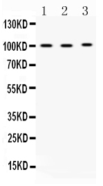 1 - Anti-ADAM2 Picoband Antibody ABO10339