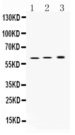 1 - Anti-ATP4B Picoband Antibody ABO10342