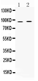 1 - Anti-AKAP2 Picoband Antibody ABO10344