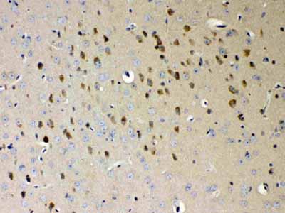 2 - Anti-NDRG3 Picoband Antibody ABO10345