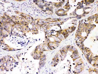 2 - Anti-NDRG3 Picoband Antibody ABO10345
