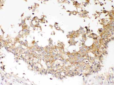 2 - Anti-NDRG3 Picoband Antibody ABO10345