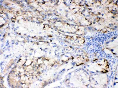2 - Anti-Hepatitis B Virus Picoband Antibody ABO10353
