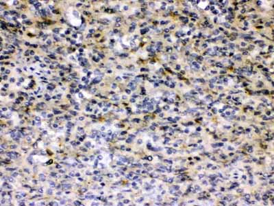 2 - Anti-Hepatitis B Virus Picoband Antibody ABO10353