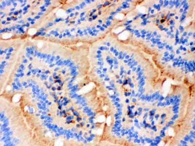 2 - Anti-Actin Antibody (Monoclonal, AC-40) ABO10397