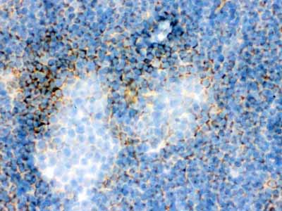 2 - Anti-Actin Antibody (Monoclonal, AC-40) ABO10397
