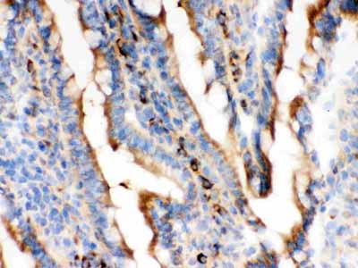 2 - Anti-Actin Antibody (Monoclonal, AC-40) ABO10397