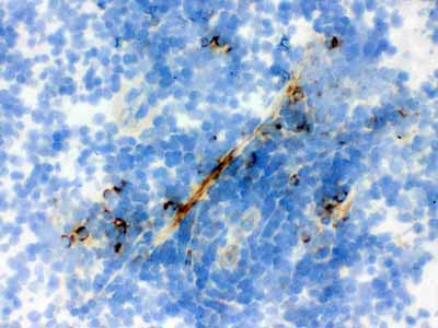 2 - Anti-Actin Antibody (Monoclonal, AC-40) ABO10397