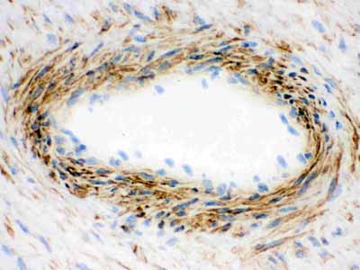 2 - Anti-Actin Antibody (Monoclonal, AC-40) ABO10397