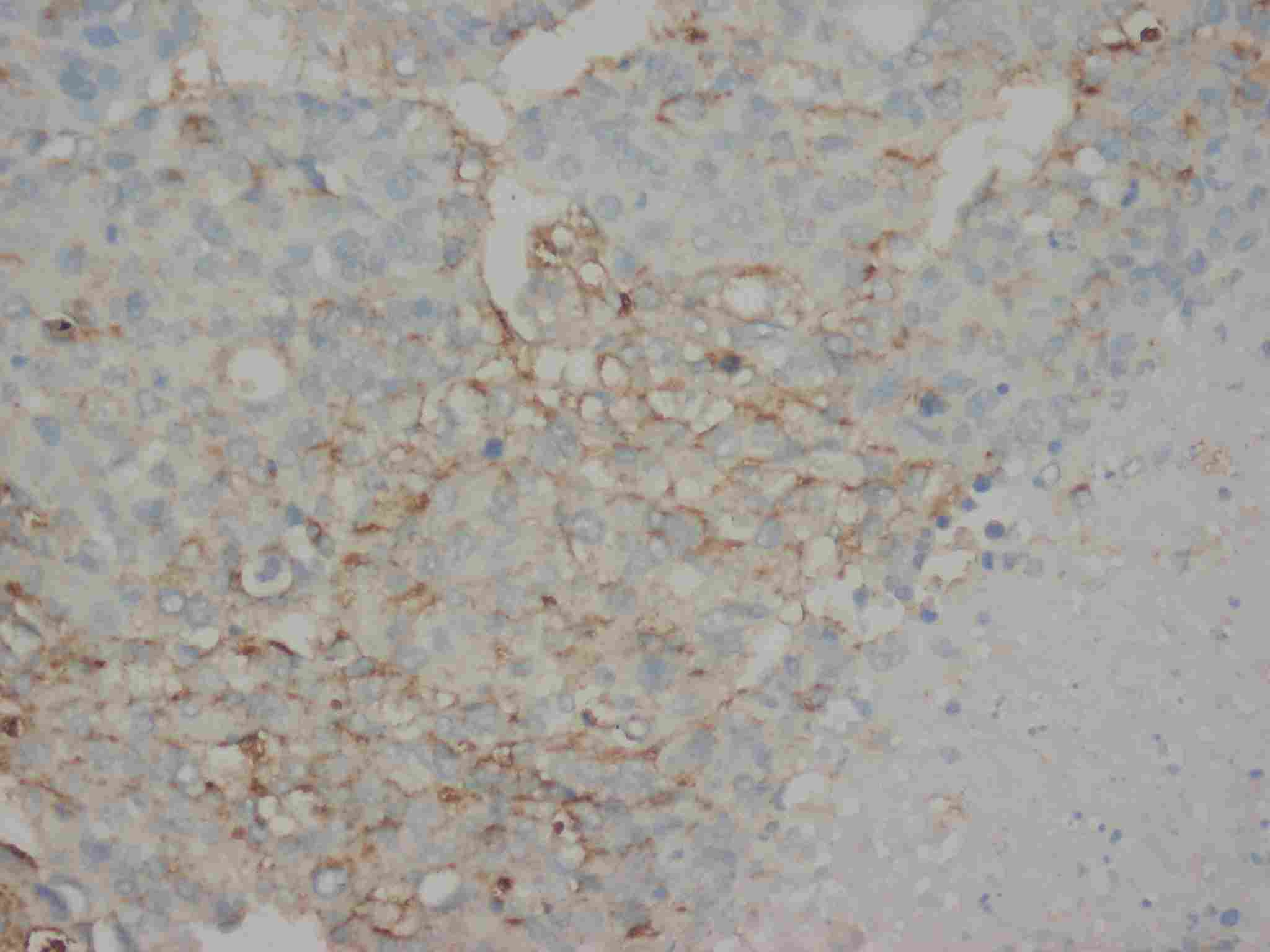 2 - Anti-AFP Antibody ABO10398