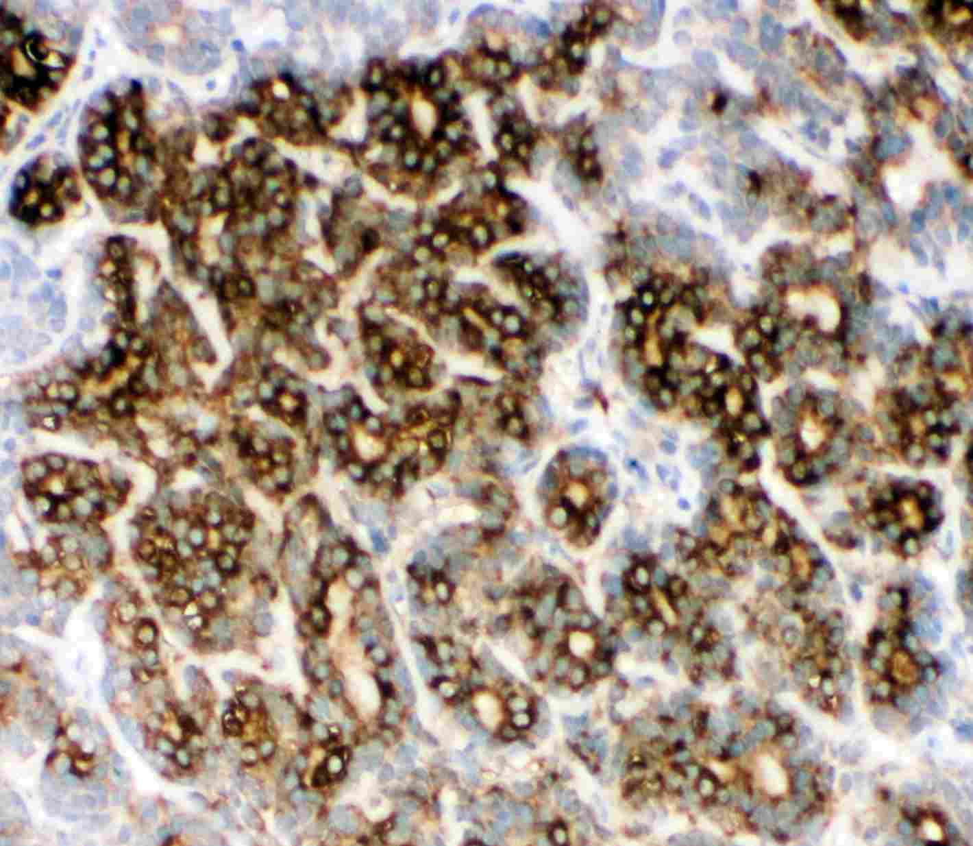 2 - Anti-AFP Antibody ABO10398