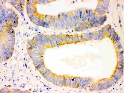2 - Anti-Bcl-2 Antibody (Monoclonal, Bcl-2-100) ABO10400