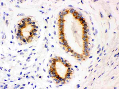 2 - Anti-Bcl-2 Antibody (Monoclonal, Bcl-2-100) ABO10400