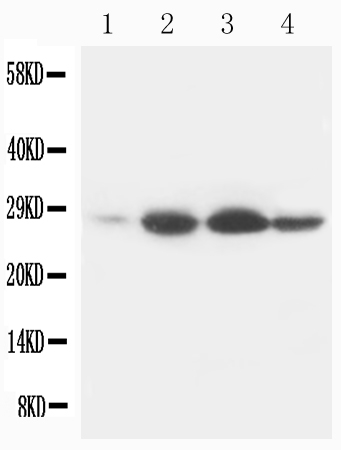1 - Anti-Bcl-2 Antibody (Monoclonal, Bcl-2-100) ABO10400