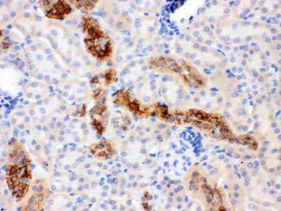 2 - Anti-Calbindin-D Antibody (Monoclonal, CB-955) ABO10402