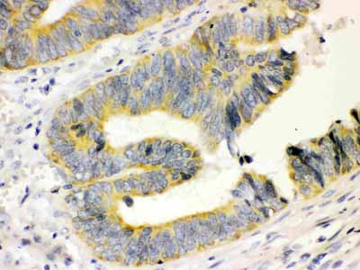 2 - Anti-Calbindin-D Antibody (Monoclonal, CB-955) ABO10402