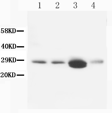 1 - Anti-Calbindin-D Antibody (Monoclonal, CB-955) ABO10402