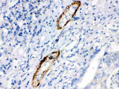 2 - Anti-Caldesmon (Smooth) Antibody (Monoclonal, hHCD) ABO10404