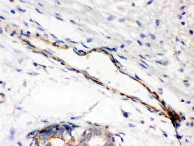 2 - Anti-Caldesmon (Smooth) Antibody (Monoclonal, hHCD) ABO10404