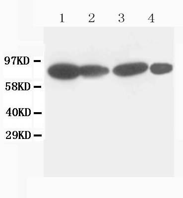 1 - Anti-Catenin Gamma (Plakoglobin) Antibody (Monoclonal, 15F11) ABO10407