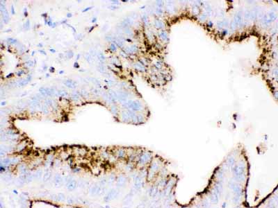 2 - Anti-Cathepsin D Antibody ABO10408