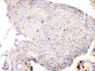 2 - Anti-Cathepsin D Antibody ABO10408