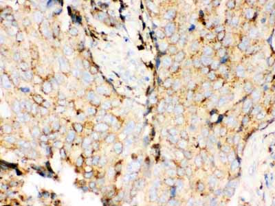 2 - Anti-Cathepsin D Antibody ABO10408