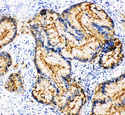 2 - Anti-CEACAM1 Antibody ABO10418
