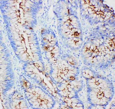 2 - Anti-CEACAM1 Antibody ABO10418