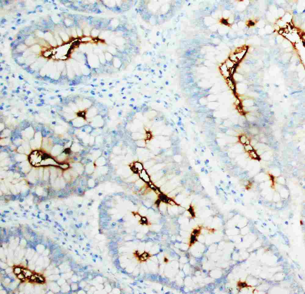 2 - Anti-CEACAM1 Antibody ABO10418