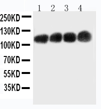 1 - Anti-CEACAM1 Antibody ABO10418