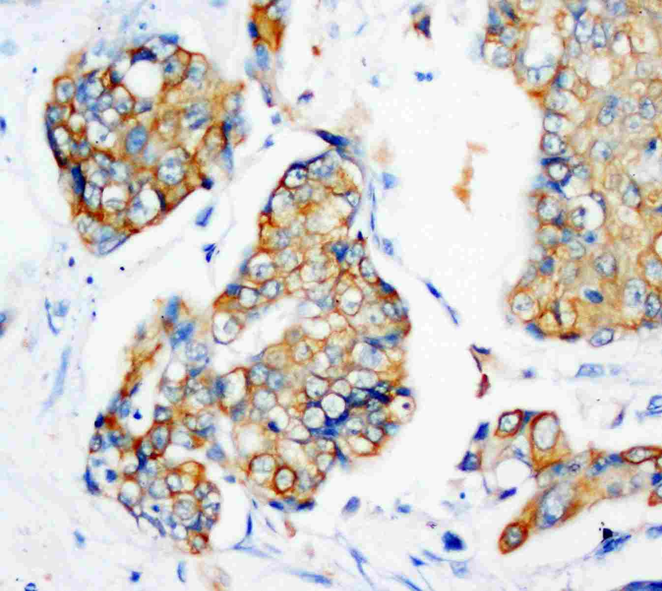2 - Anti-Cytokeratin Peptide 18 Antibody (Monoclonal, CY-90) ABO10420