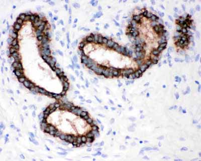 2 - Anti-Cytokeratin Peptide 18 Antibody (Monoclonal, CY-90) ABO10420
