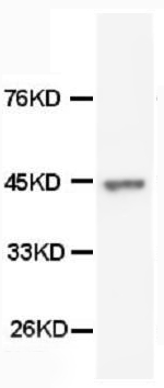 1 - Anti-Cytokeratin Peptide 18 Antibody (Monoclonal, CY-90) ABO10420