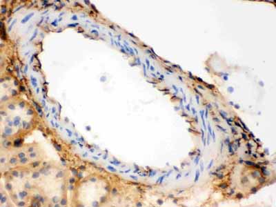 2 - Anti-Collagen, Type III Antibody (Monoclonal, FH-7A) ABO10422