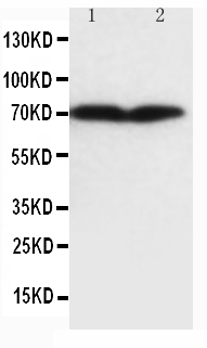 1 - Anti-Collagen, Type III Antibody (Monoclonal, FH-7A) ABO10422