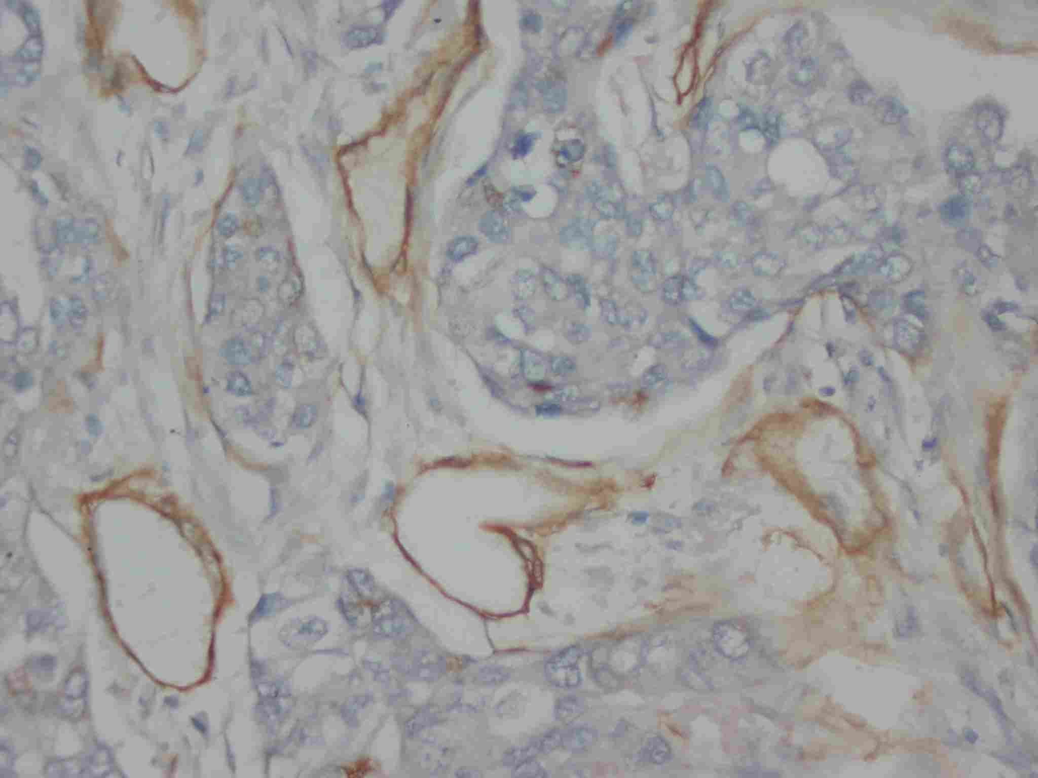 2 - Anti-Collagen, Type IV Antibody (Monoclonal, COL-94) ABO10423
