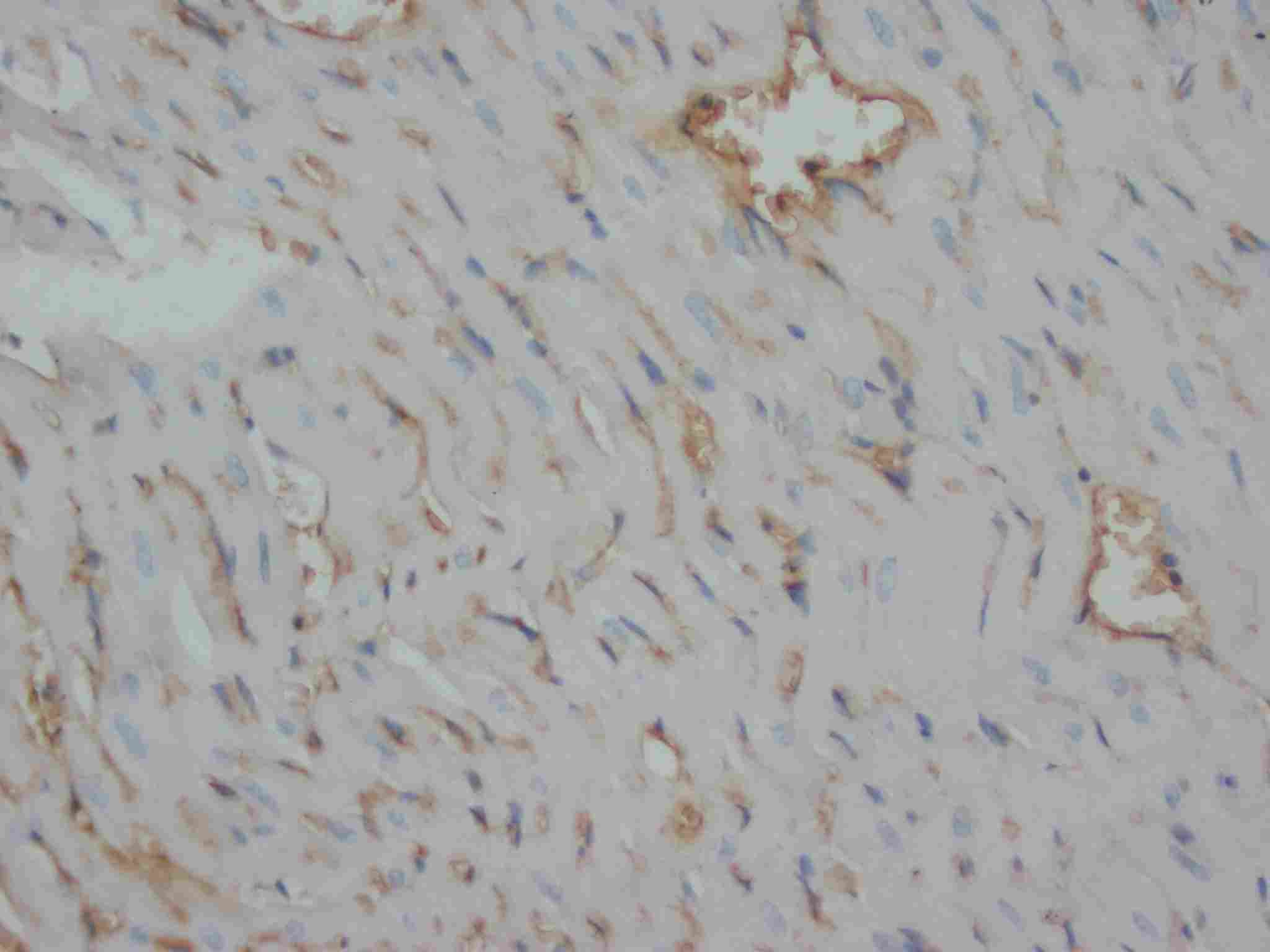 2 - Anti-Desmin Antibody (Monoclonal, DE-U-10) ABO10427