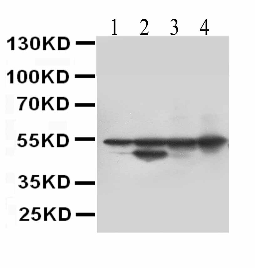 1 - Anti-Desmin Antibody (Monoclonal, DE-U-10) ABO10427