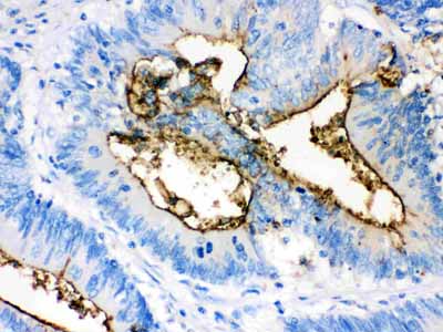 2 - Anti-Episialin, EMA Antibody (Monoclonal, GP1.4) ABO10430