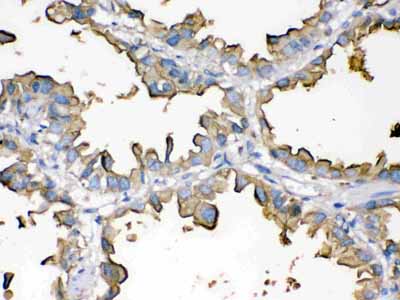 2 - Anti-Episialin, EMA Antibody (Monoclonal, GP1.4) ABO10430