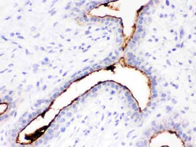 2 - Anti-Episialin, EMA Antibody (Monoclonal, GP1.4) ABO10430
