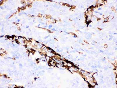 2 - Anti-Gelsolin Antibody (Monoclonal, GS-2C4) ABO10434