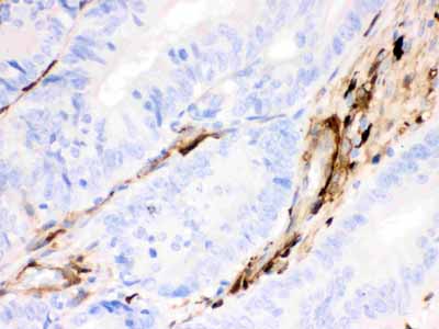 2 - Anti-Gelsolin Antibody (Monoclonal, GS-2C4) ABO10434