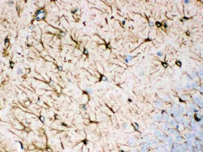 2 - Anti-GFAP Antibody (Monoclonal, G-A-5) ABO10435