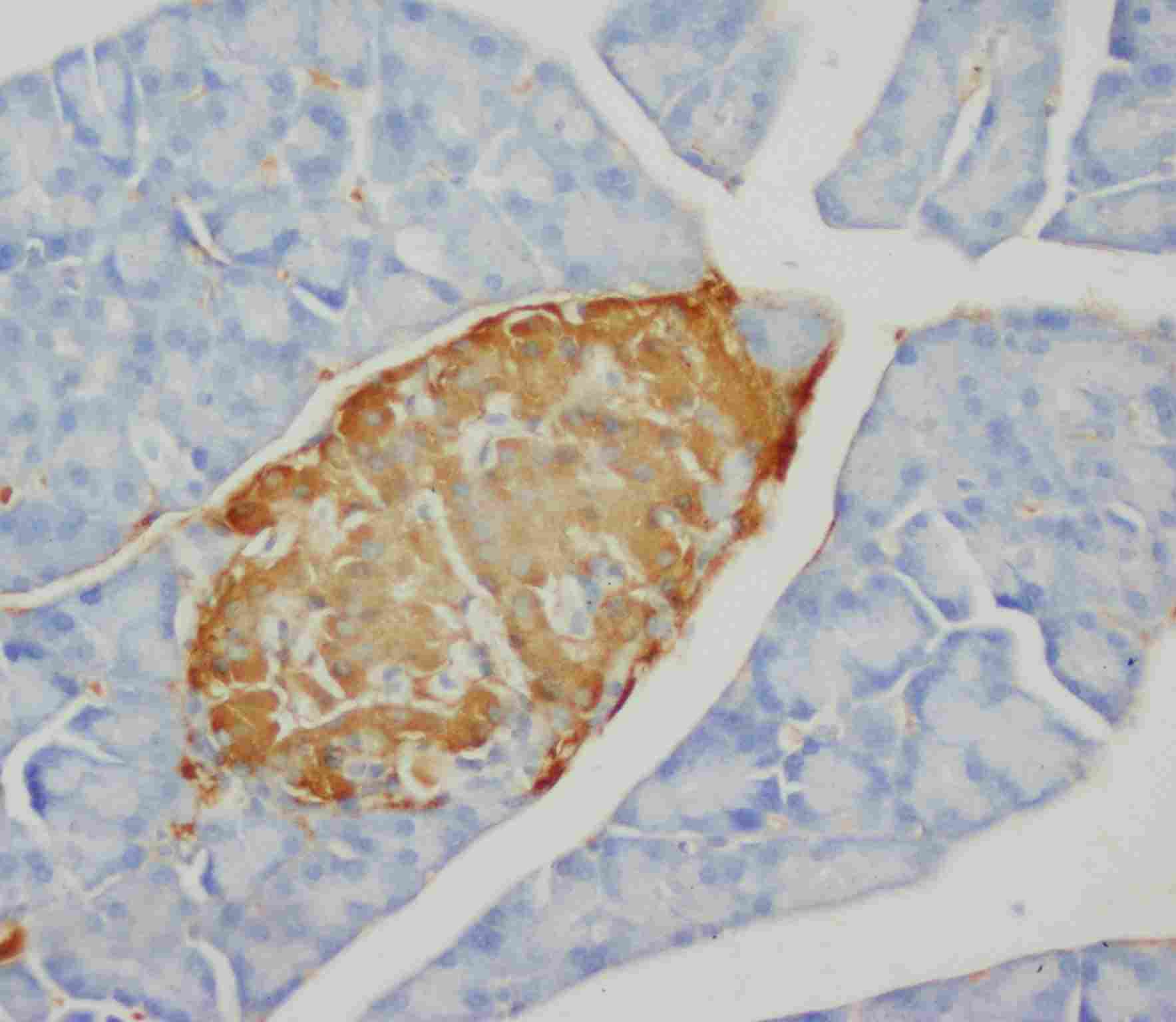2 - Anti-Insulin Antibody (Monoclonal, K36AC10) ABO10441
