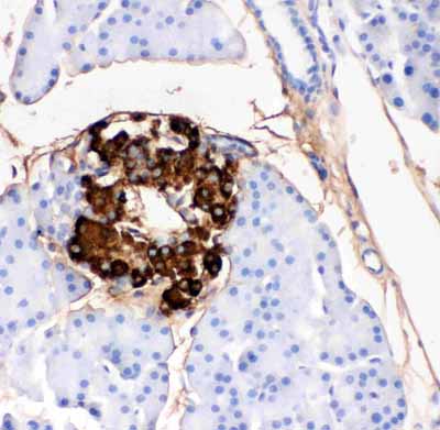 2 - Anti-Insulin Antibody (Monoclonal, K36AC10) ABO10441